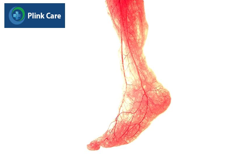 Khám tầm soát bàn chân đái tháo đường