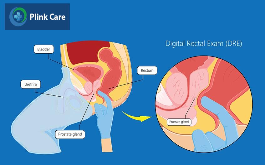 khám trực tràng