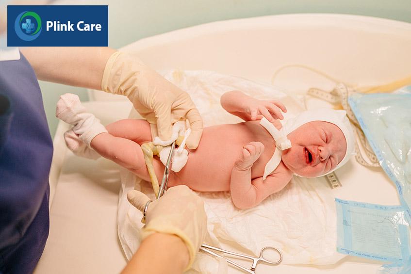 Sau khi trẻ sinh ra dây rốn không còn cần thiết nên sẽ được bác sĩ cắt đi, chỉ còn lại cuống rốn sẽ tự teo lại và rụng đi