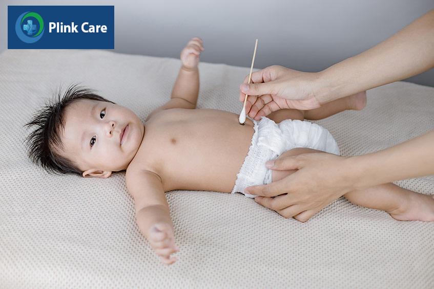 Bố mẹ nên mặc tã phía dưới rốn, làm khô rốn để rốn tiếp xúc nhiều với không khí và nhanh khô