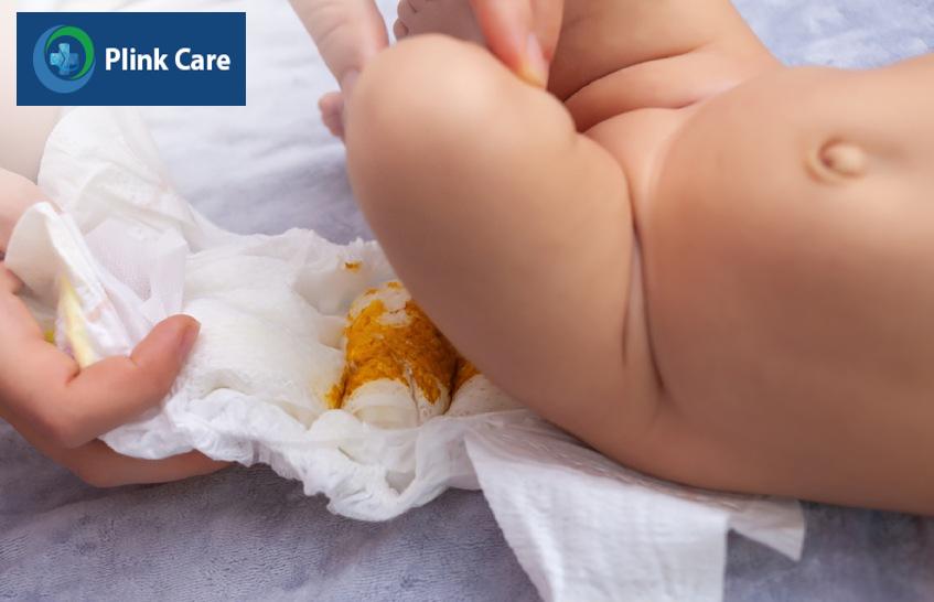 Quan sát màu sắc, hình thái phân