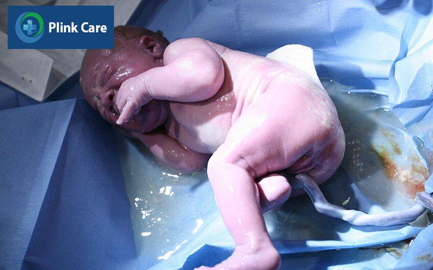 tế bào gốc trung mô dây rốn