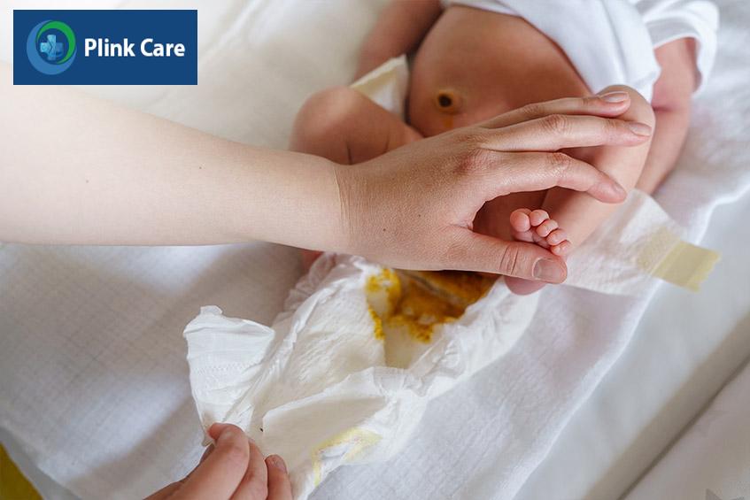 Trẻ sơ sinh bú mẹ thường sẽ đi ngoài khoảng 6 - 8 lần/ngày, thường xảy ra sau khi trẻ được bú no