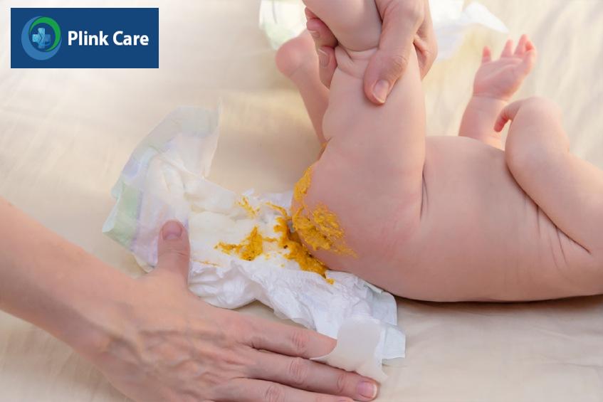 Trẻ sơ sinh đi ngoài phân vàng có hạt trắng