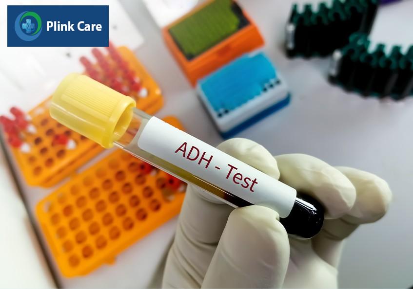 Xét nghiệm định lượng ADH trong máu