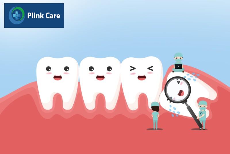 Tầm quan trọng của việc chăm sóc sau khi nhổ răng khôn
