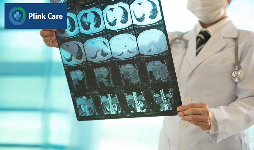 chụp ct thận phát hiện bệnh gì