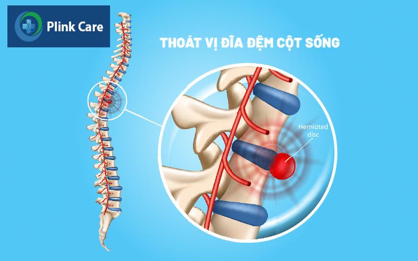 phương pháp phẫu thuật ít xâm lấn