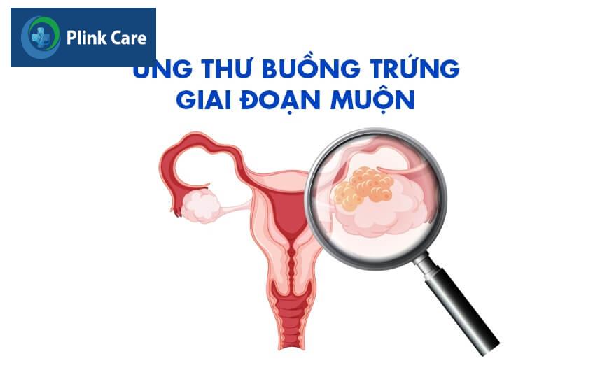 ung thư buồng trứng giai đoạn muộn