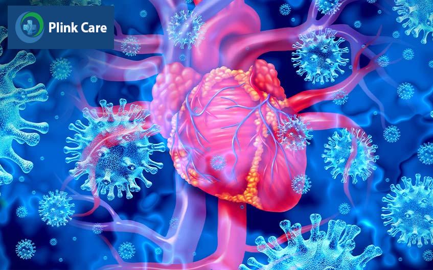 Viêm cơ tim là bệnh lý rất nguy hiểm