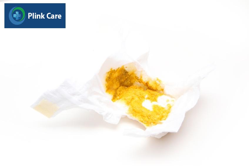Các cách điều trị tiêu chảy ở trẻ sơ sinh khác