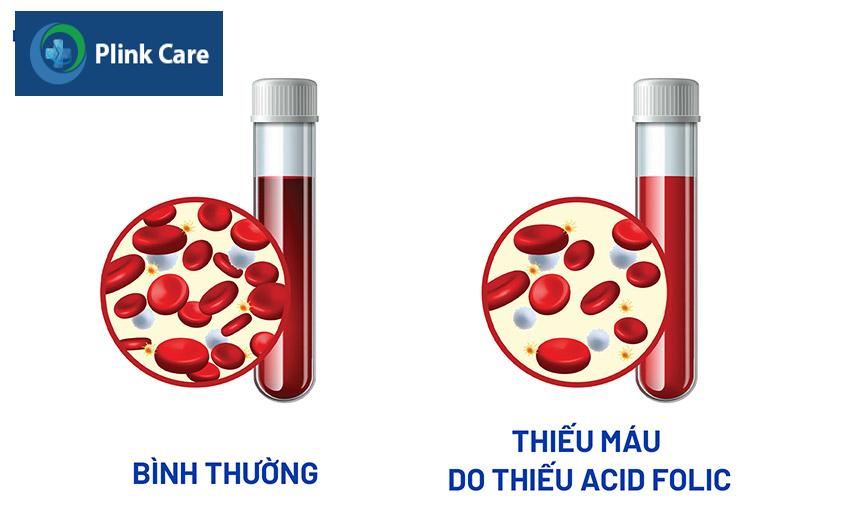 cơ thể không đủ các tế bào hồng cầu