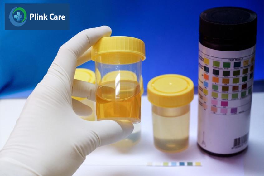 dấu hiệu nước tiểu màu cam