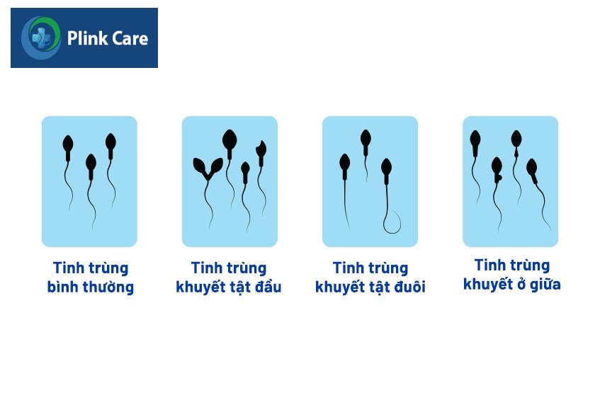 hình minh họa các vấn đề tinh trùng