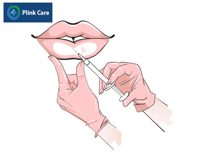 lựa chọn tiêm tan filler khi bị vón cục