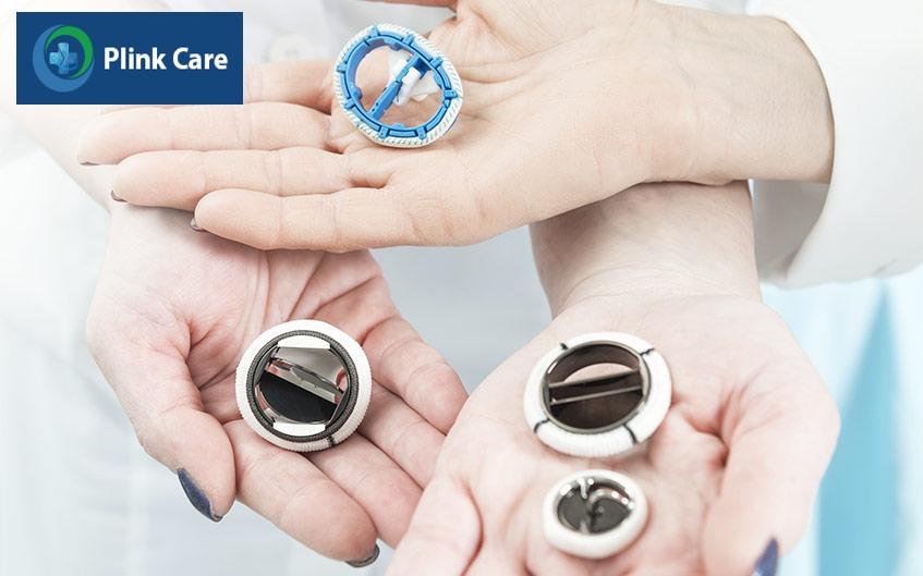 Thay van tim sống được bao nhiêu năm tùy thuộc vào loại van tim được chọn để thay thế