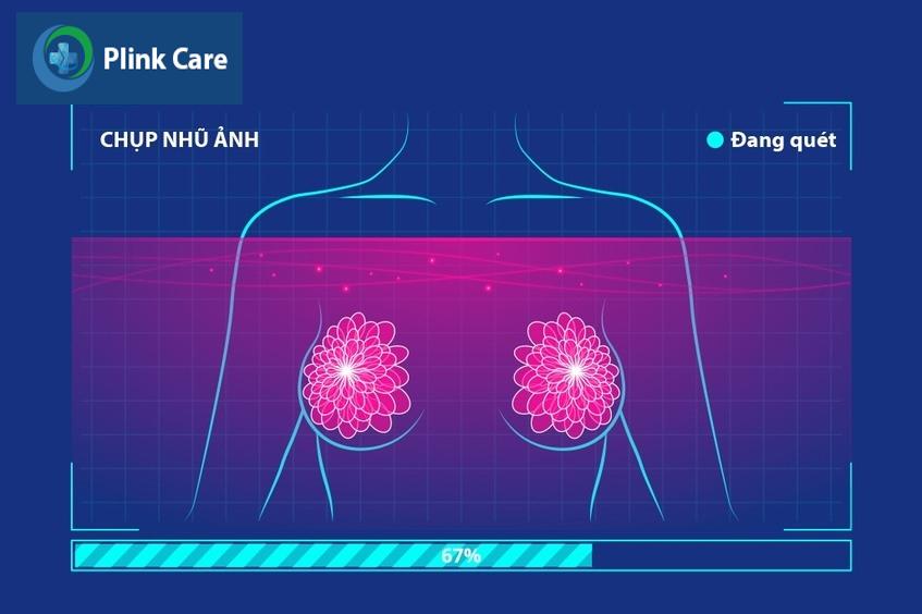 chụp nhũ ảnh tăng cường tương phản