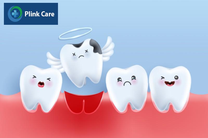 Trường hợp nên nhổ răng bằng sóng siêu âm Piezotome