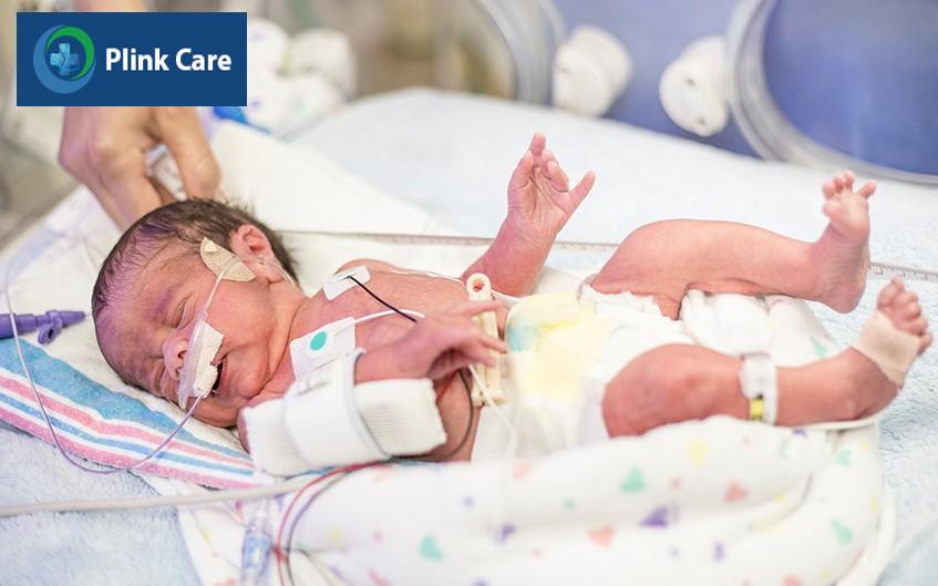 trẻ sinh non phải đối mặt với nhiều nguy cơ