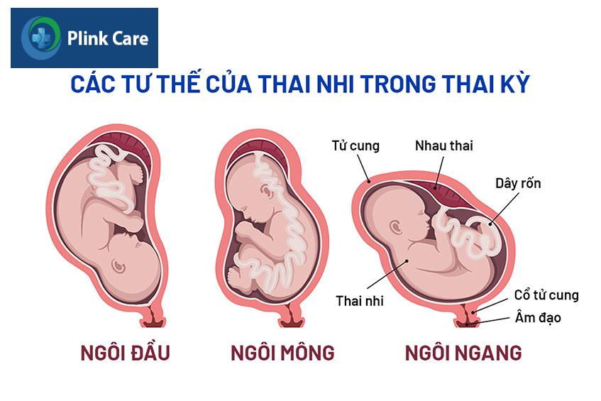 tư thế của thai nhi