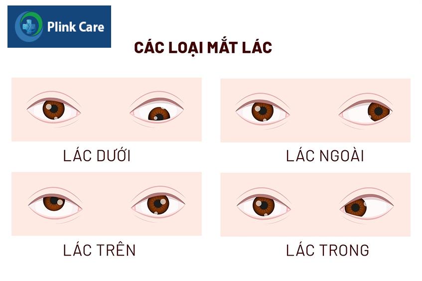 bị lác