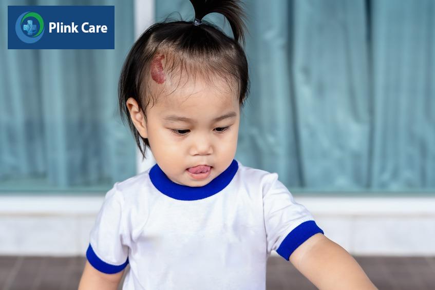 Bướu máu ở trẻ em cần được theo dõi và can thiệp phù hợp
