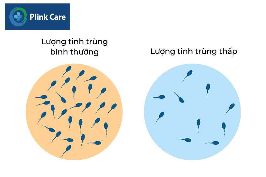 Cách trị tinh trùng loãng là như thế nào?
