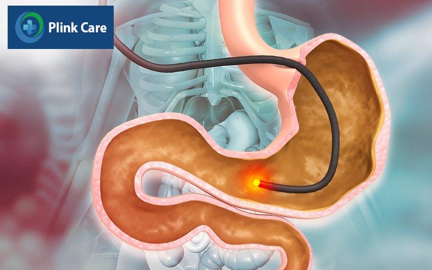chẩn đoán bệnh gist dạ dày