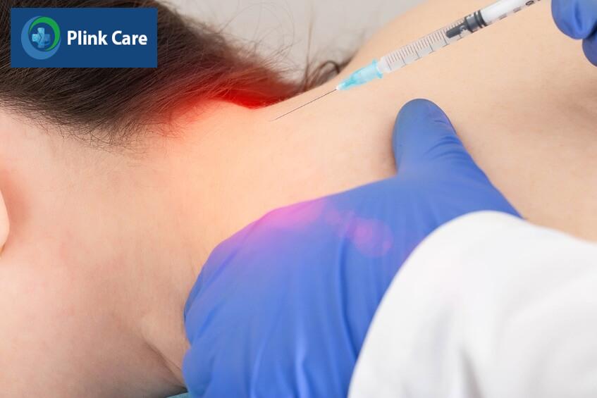 chẩn đoán đau dây thần kinh chẩm