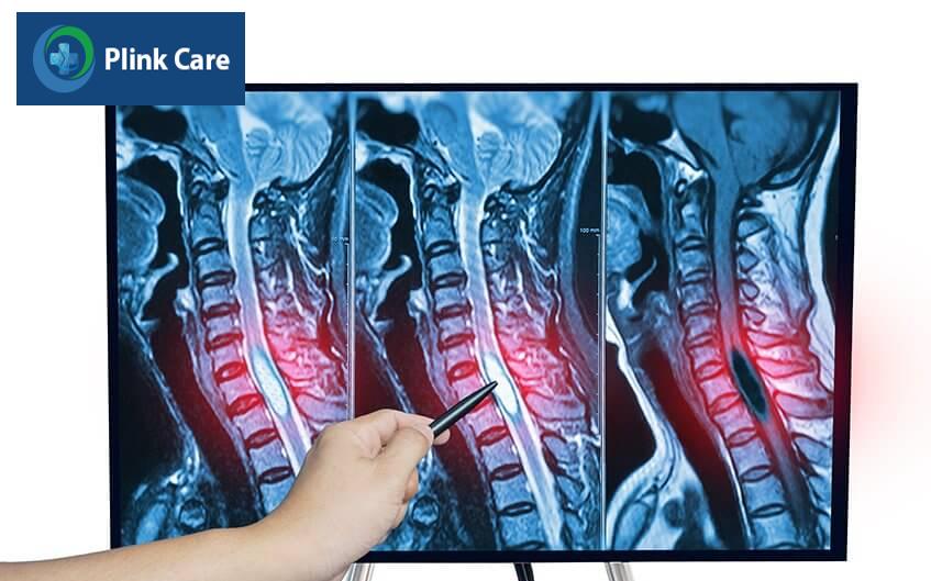 chỉ định phẫu thuật khối u cột sống