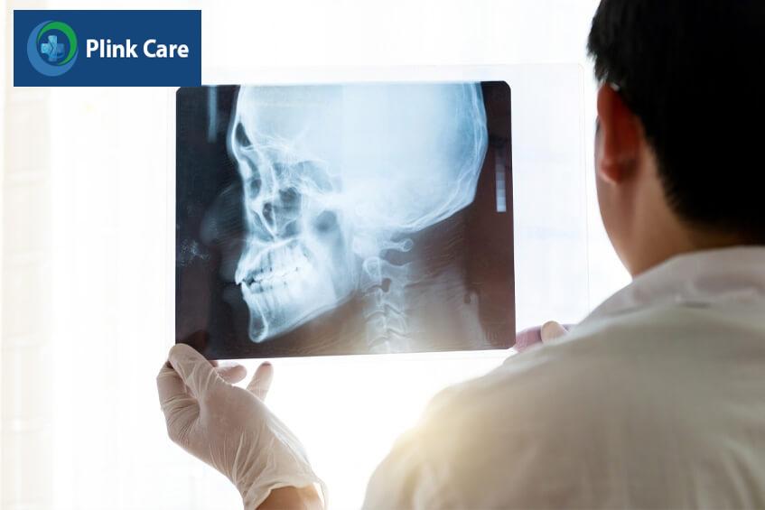 chụp x-quang chẩn đoán đau đầu chóng mặt buồn nôn mệt mỏi khó thở