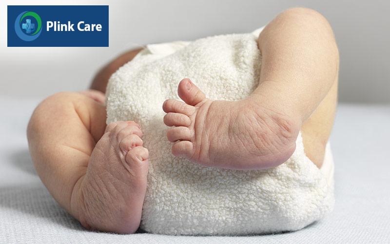 Dị tật bàn chân ở trẻ