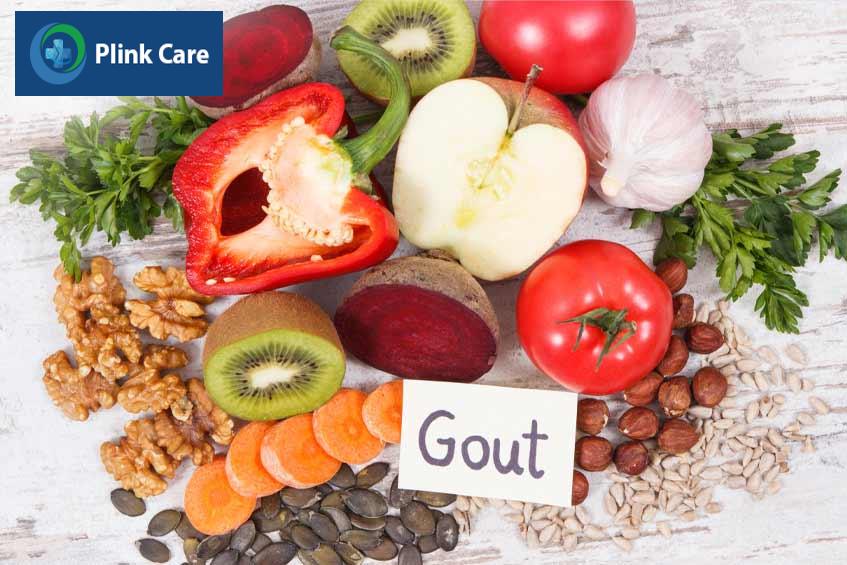Chế độ dinh dưỡng đóng vai trò quan trọng trong quá trình điều trị bệnh gout