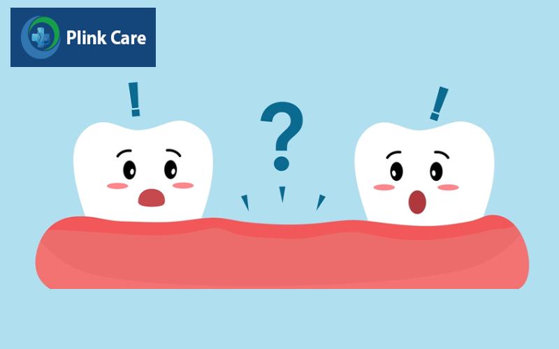 Các kiểu răng khôn mọc lệch, Răng khôn mọc kẹt về phía gần