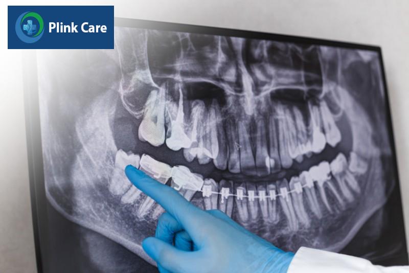 Các biện pháp chẩn đoán viêm lợi trùm