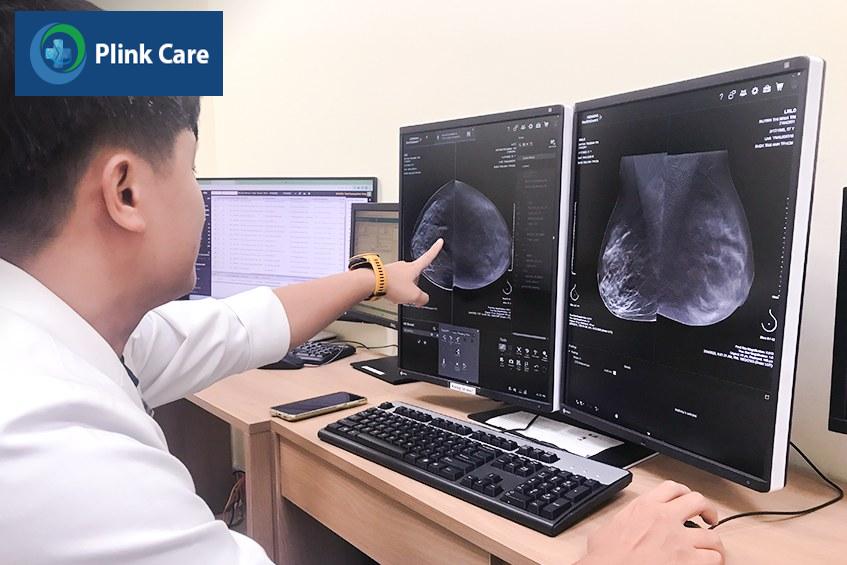 ngừa ung thư vú uống thuốc gì