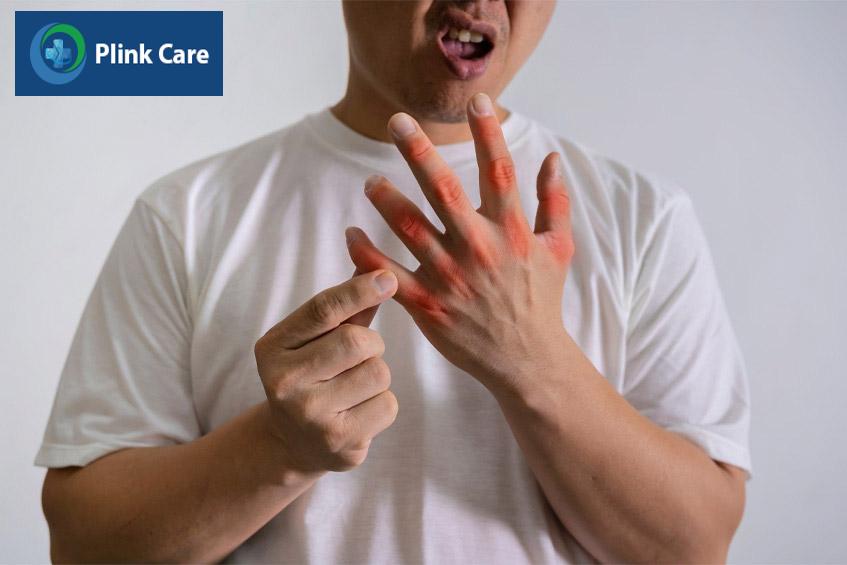 Người bệnh gout thường có nguy cơ cao bị ngón tay cò súng