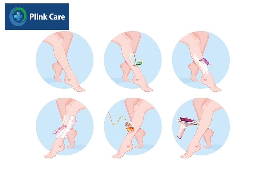 những phương pháp không phải triệt lông