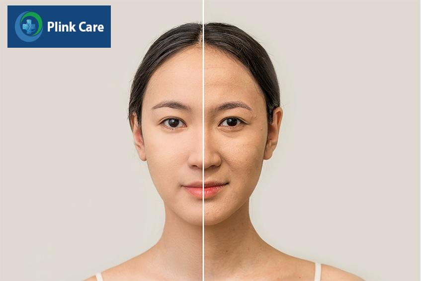 tác dụng của peel da mặt