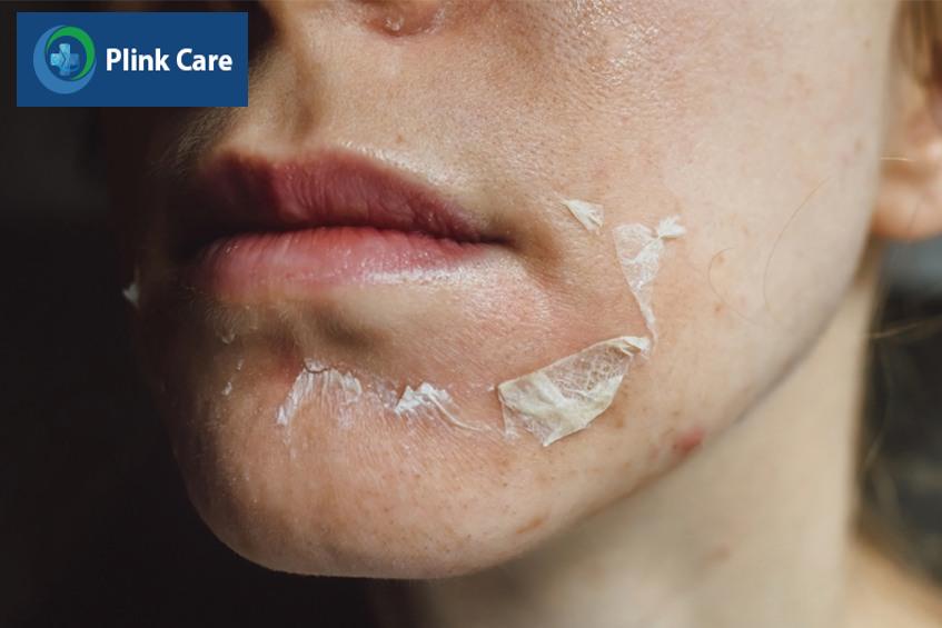 tca có tác dụng gì