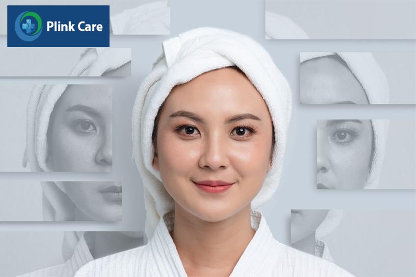 ưu điểm của tca