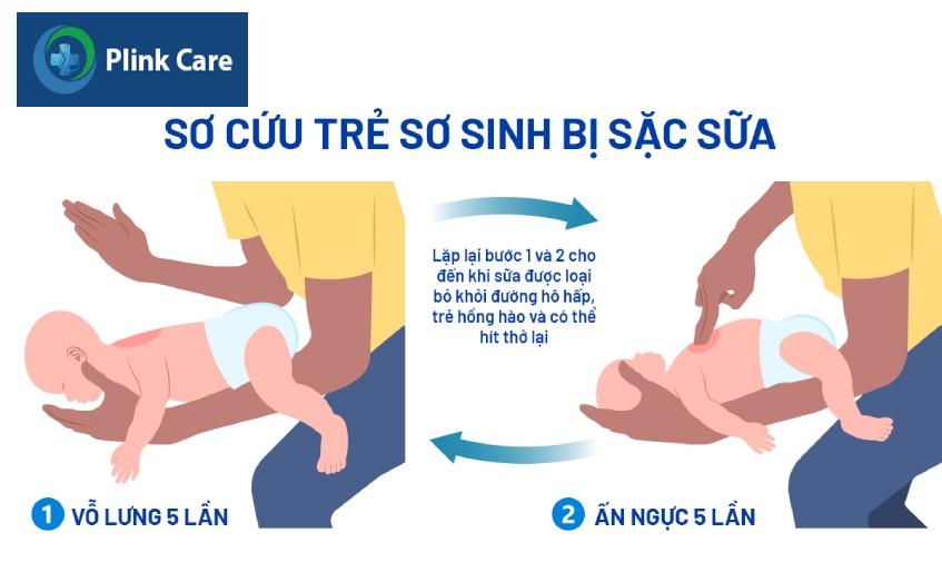 Vỗ lưng và ấn ngực giúp trẻ loại bỏ sữa ra khỏi đường hô hấp