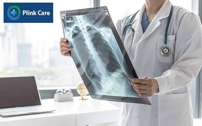 x quang phổi copd