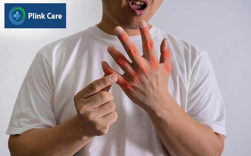 Xét nghiệm hỗ trợ bác sĩ trong chẩn đoán bệnh gout