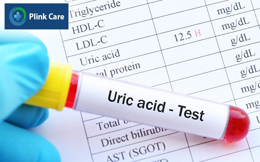 xét nghiệm nồng độ acid uric trong máu