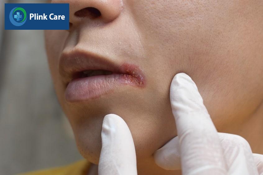 B12 Ankermann 1000mcg là thuốc gì?
