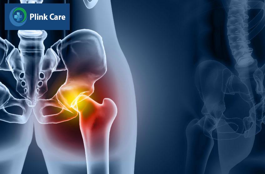 bệnh khiến khớp bị bất động
