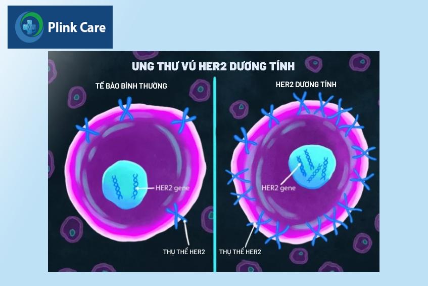 cách chữa ung thư vú her2 dương tính
