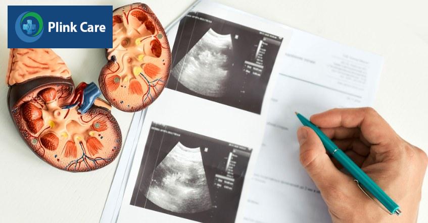chẩn đoán thận ứ nước độ 1