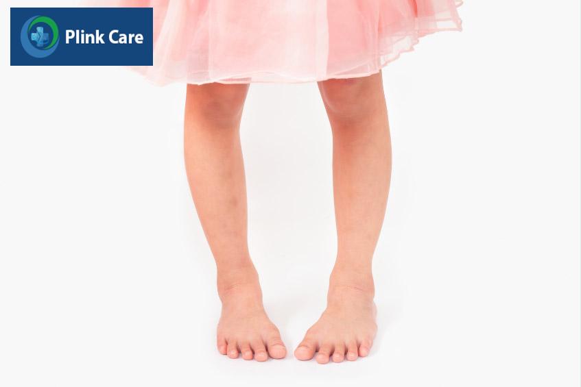 dị tật ảnh hưởng đến khả năng đi lại của trẻ
